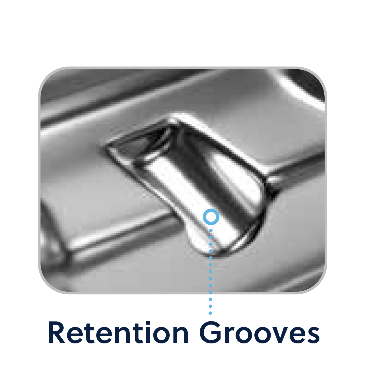Design features retention grooves