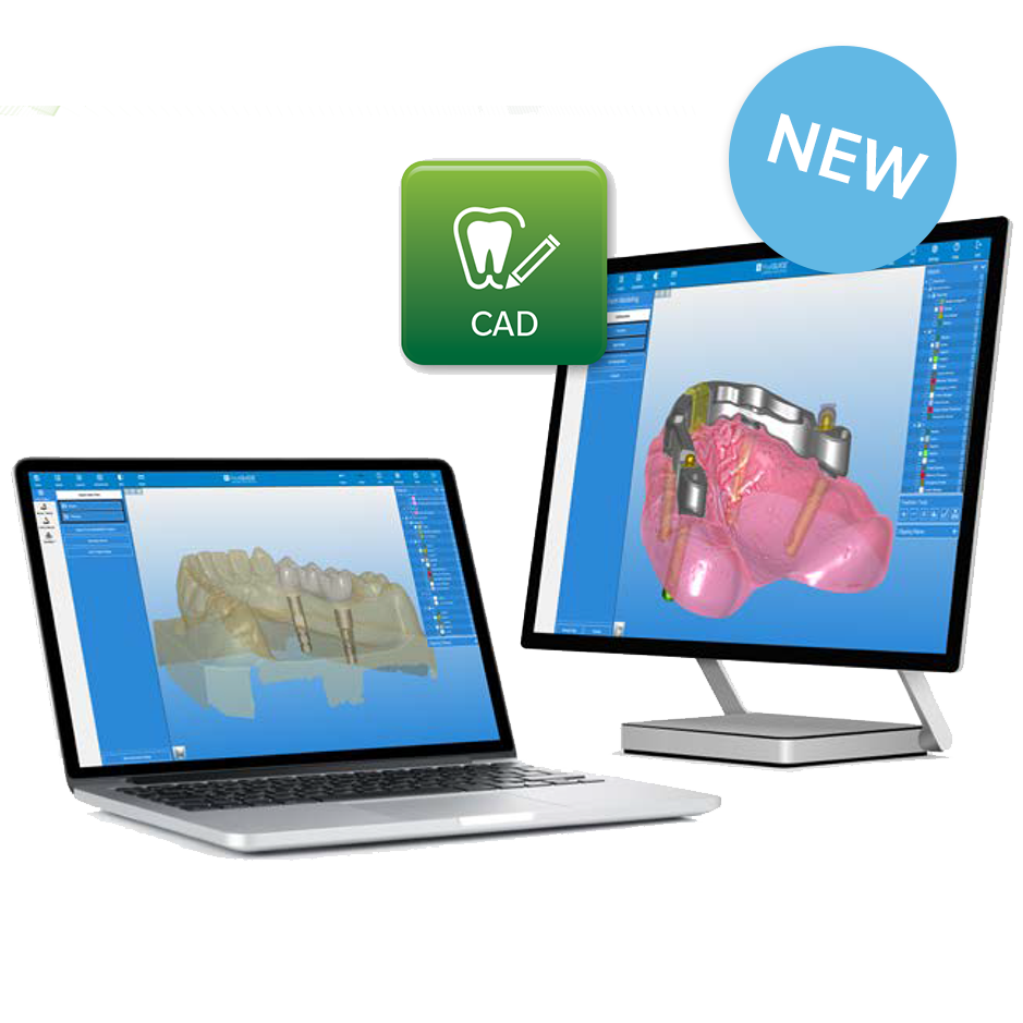 Laptop and a desktop monitor side-by-side, both displaying dental CAD (Computer-Aided Design) software..