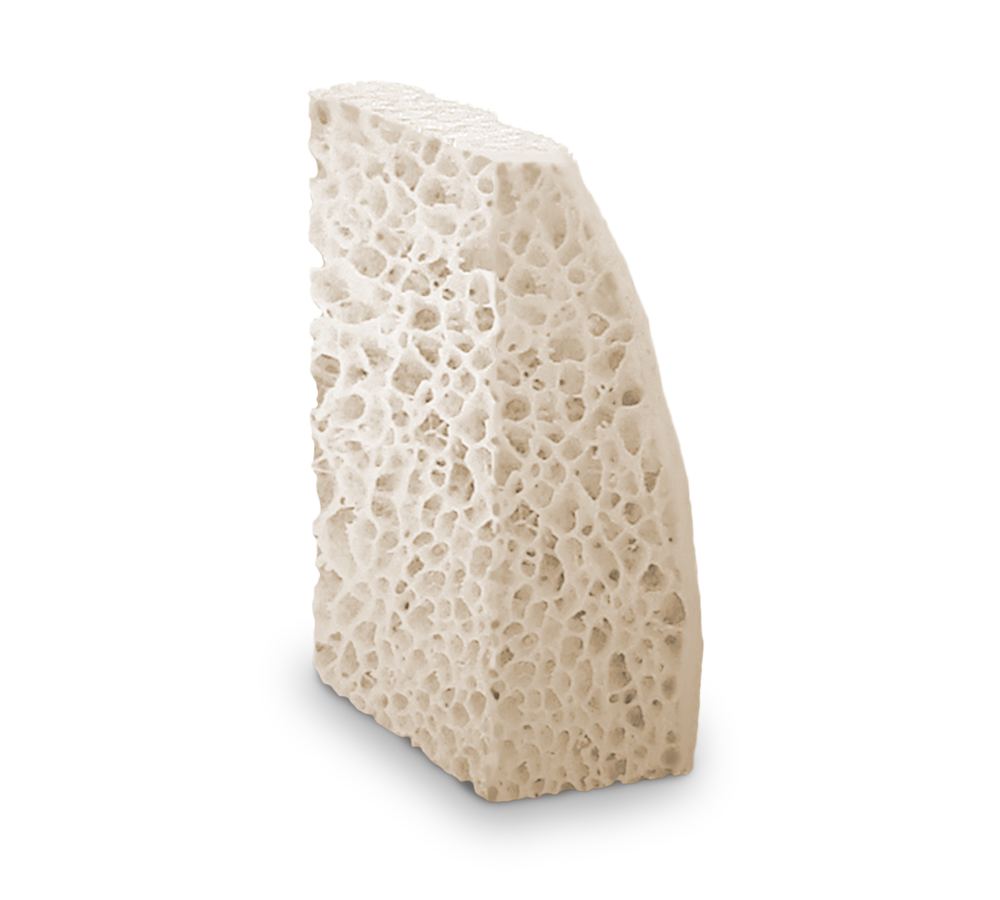 Puros® Block Allograft