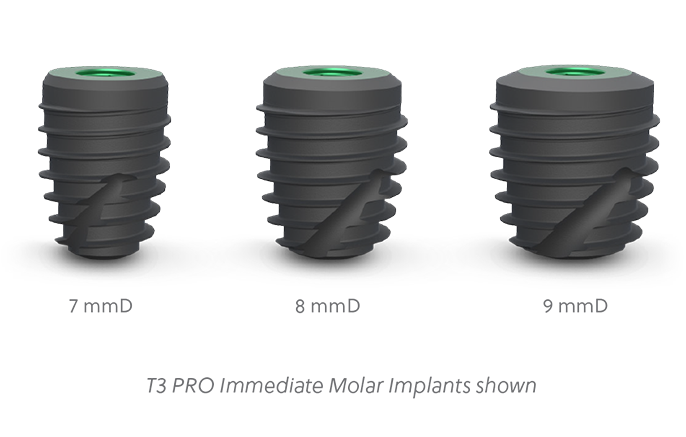 Stability in Immediate Molar Placement