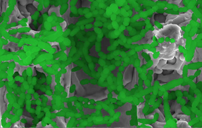 Microscopic view of the Southern Implants SInergy surface, highlighting a rough, porous topography densely covered with green-marked areas, representing enhanced surface features for osseointegration.