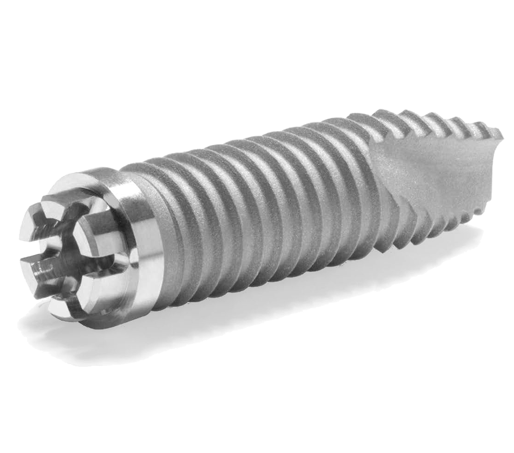 ZimVie Spline Twist Dental Implant Close-up image of the ZimVie Spline Twist Dental Implant, showcasing its precision-engineered design with interdigitating projections and self-tapping spiral flutes that reduce surgical time, enhance stability, and facilitate bone chip removal. This implant also supports the Snap Delivery System for convenient and sterile placement, and offers surface options including MTX™ Microtextured Surface and MP-1® HA Coating.