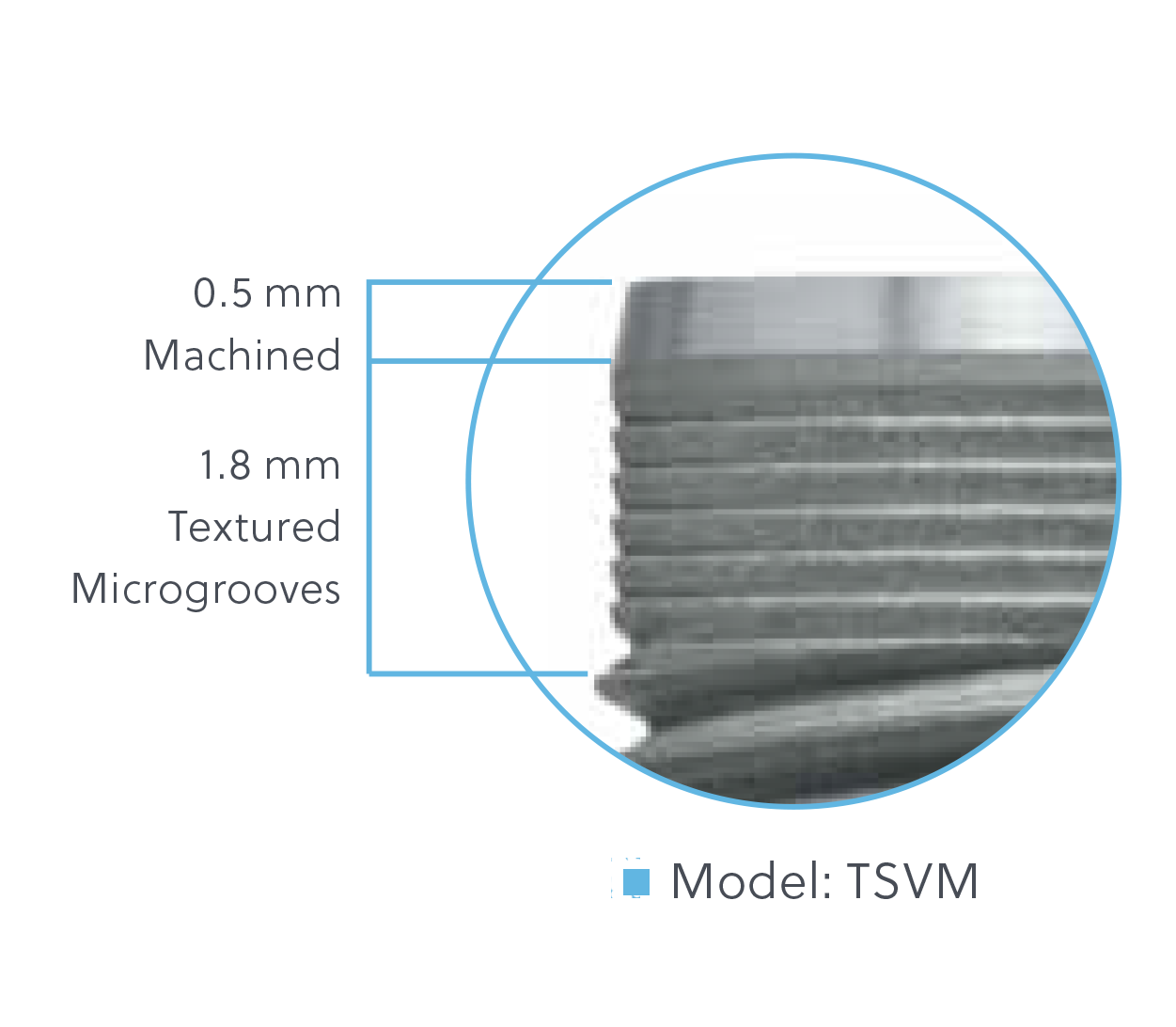 TSV Implant Configurations available on select implants Model: TSVM