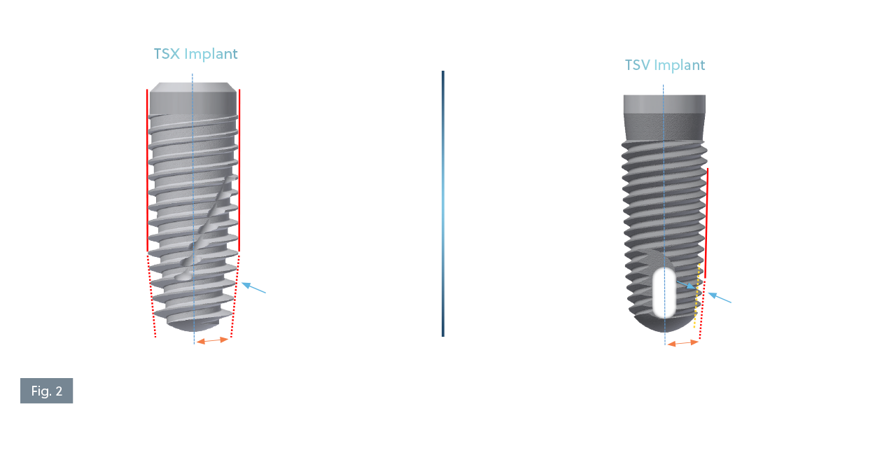 Digital CAD models of the ZimVie TSX® implant (left) and TSV® implant (right), both 4.7mm x 13mm. The image highlights design differences: TSX features a 0.64mm apical thread depth and a 6° taper, while TSV shows a 0.35mm apical thread depth and a 5° taper. Colored lines indicate major and minor diameter tapers, and arrows emphasize thread depth for comparison.