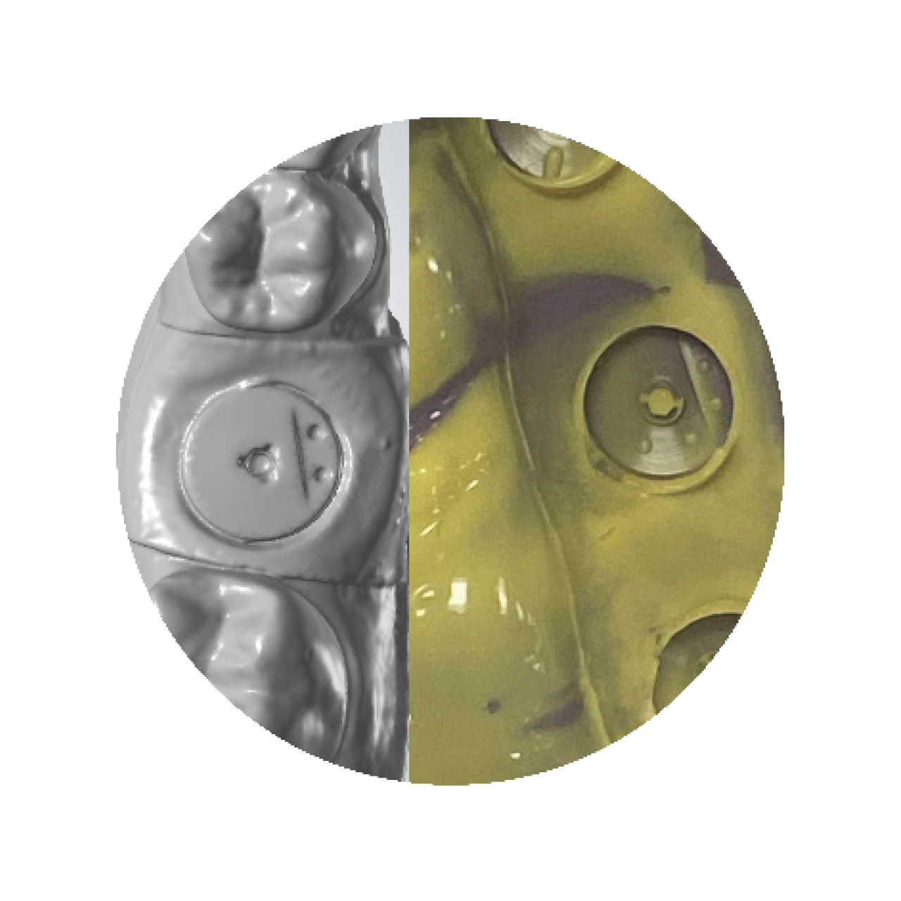 Take a PVS impression or Intraoral Scan of the Encode Healing abutment