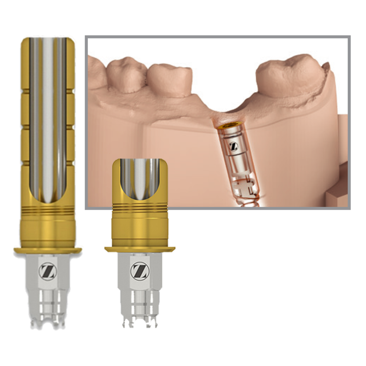 ZimVie Dental Certain Bellatek Flex Express Abutment Encode Emergence Flex Express ZV
