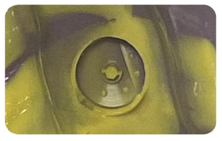 encode emergence impression system traditional pvs impression encode emergence impression system traditional pvs impression