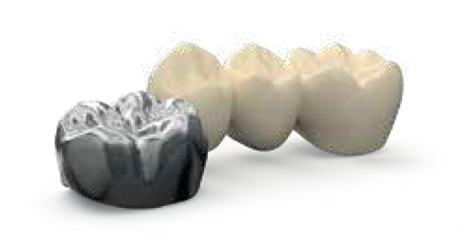 ZimVie Dental Crown and Bridge