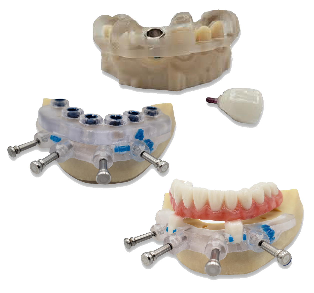Image showcasing guided surgery models and provisional restorations alongside a service list. Guided Surgical Services include treatment planning, surgical guide designs, 3D-printed surgical guides, surgery-ready provisionals, and radiology interpretations. Powered by RealGUIDE® Universal Open System, these solutions support precision and efficiency in dental implant procedures.