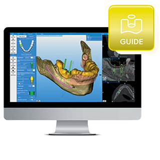 RealGUIDE® Digital Implant Planning Workflow - Guide Module