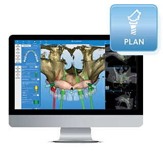 RealGUIDE® PLAN