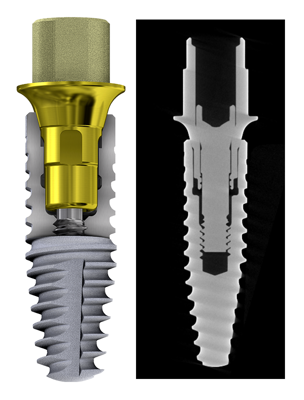 Azure Multi-Platform Prosthetic Solutions​  Your Connection for Every Connection​